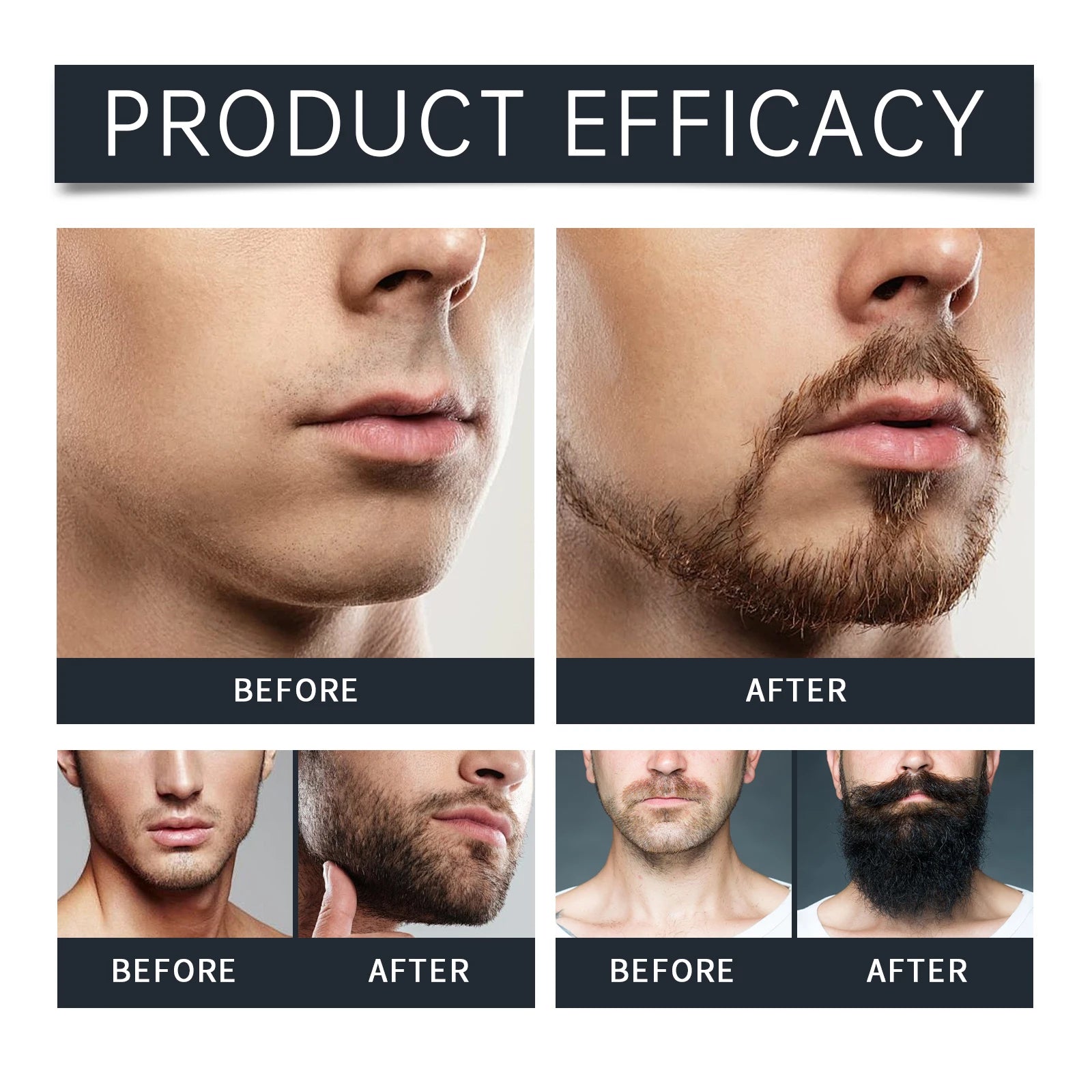East Moon Beard Care Set – Growth & Grooming Kit for Men