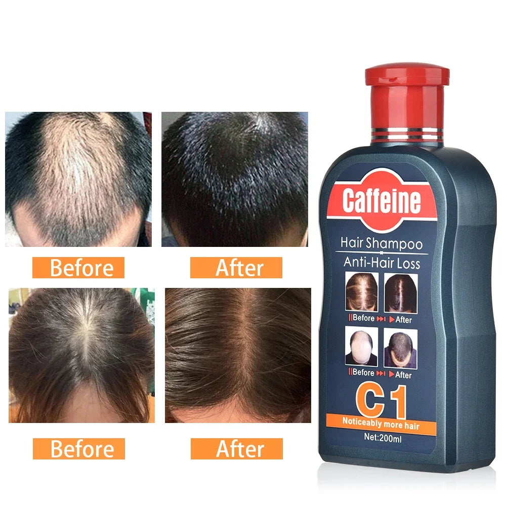 MaxThick™ Anti-Dandruff Shampoo for Stronger, Fuller Hair – 200ml