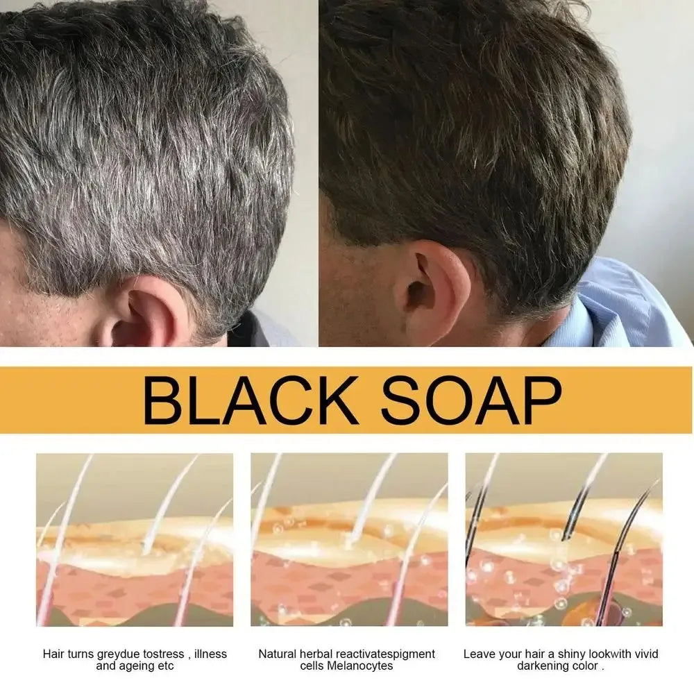 Men’s Herbal Hair Soap – Polygonum Multiflorum for Fuller, Darker Hair