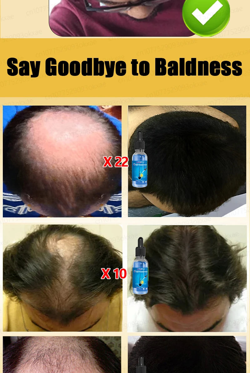 Men’s Hair Regrowth Essential Oil – Targets Bald Spots & Hair Loss, Boosts Thickness Naturally