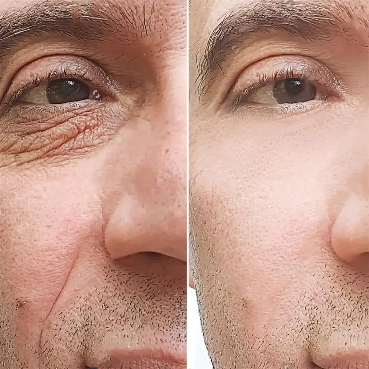 Men’s Retinol Anti-Wrinkle Cream