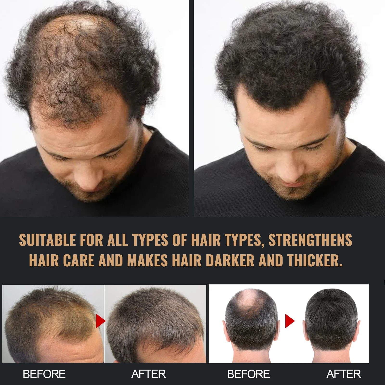 Oil Control & Anti-Dandruff Shampoo