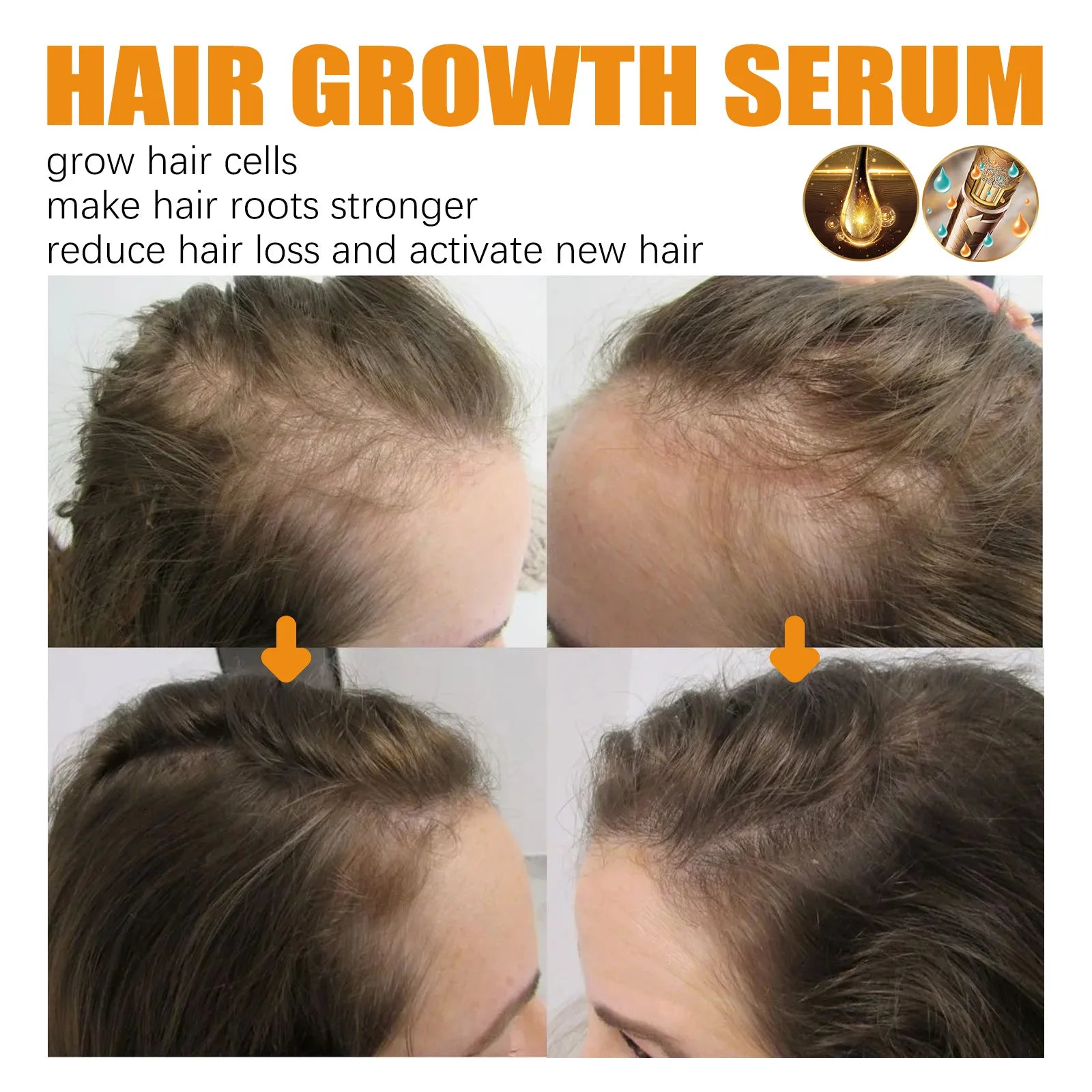 EELHOE Biotin Hair Growth Spray for Men – Strengthen Roots & Thicken Hair (30ml)