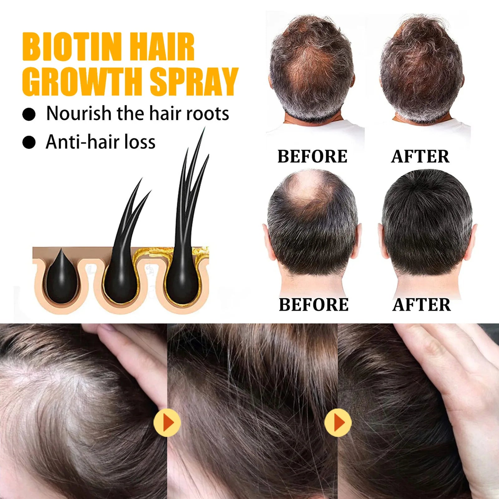 EELHOE Biotin Hair Growth Spray for Men – Strengthen Roots & Thicken Hair (30ml)