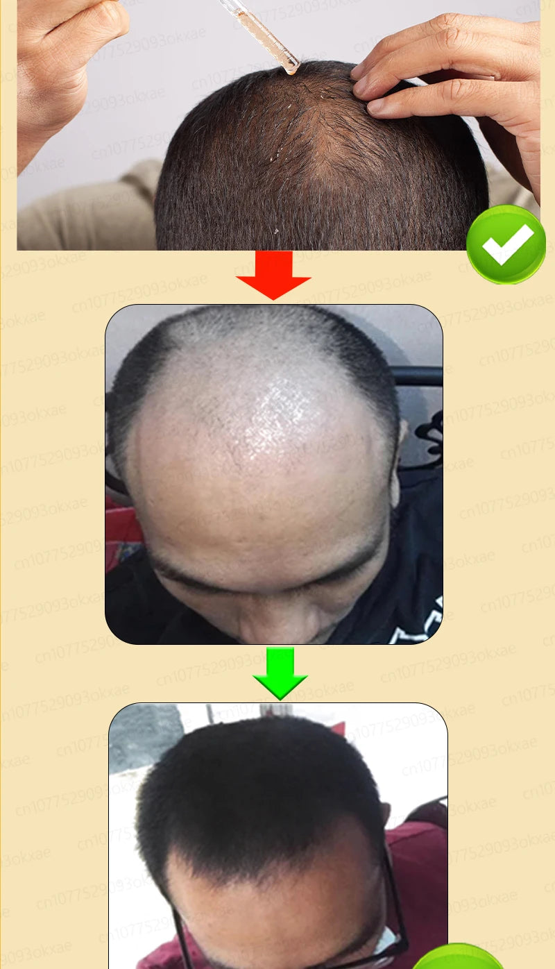 Men’s Hair Regrowth Essential Oil – Targets Bald Spots & Hair Loss, Boosts Thickness Naturally
