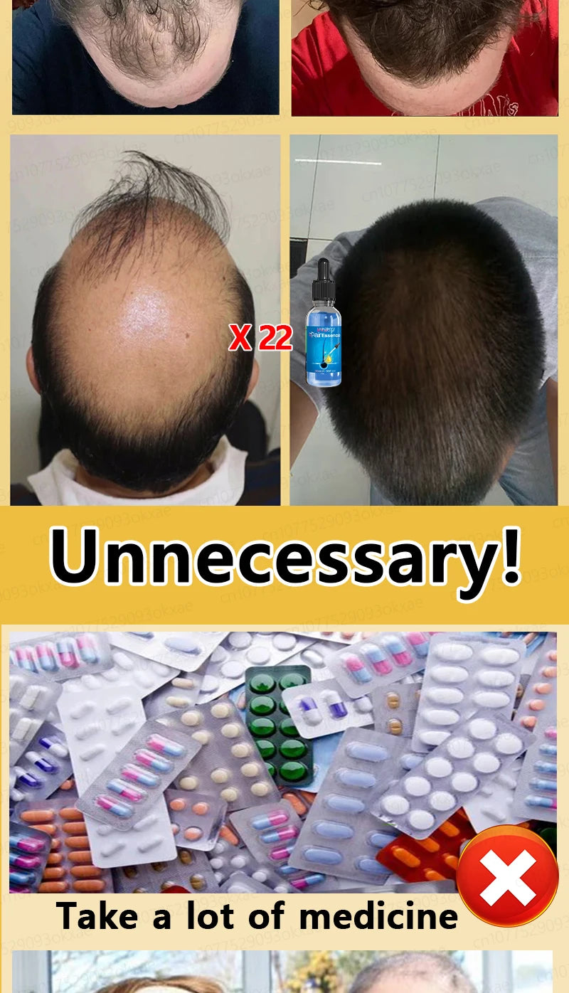 Men’s Hair Regrowth Essential Oil – Targets Bald Spots & Hair Loss, Boosts Thickness Naturally