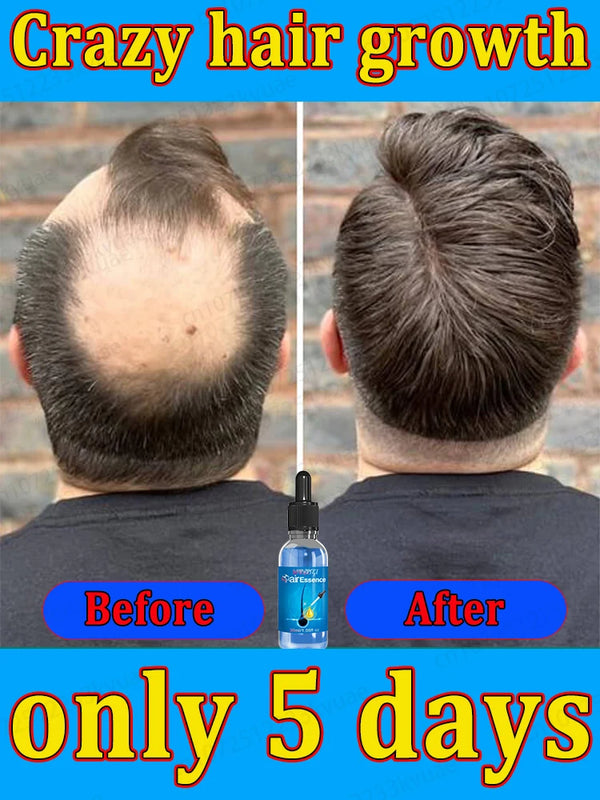 Men’s Hair Regrowth Essential Oil – Targets Bald Spots & Hair Loss, Boosts Thickness Naturally