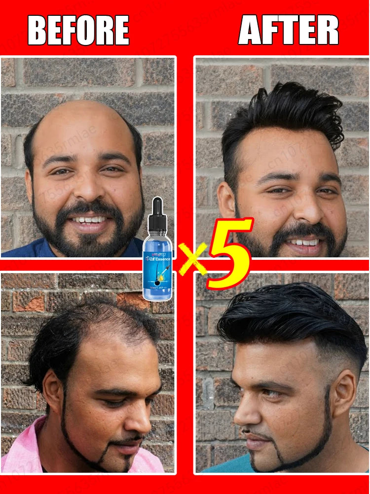 Men’s Hair Regrowth Essential Oil – Targets Bald Spots & Hair Loss, Boosts Thickness Naturally