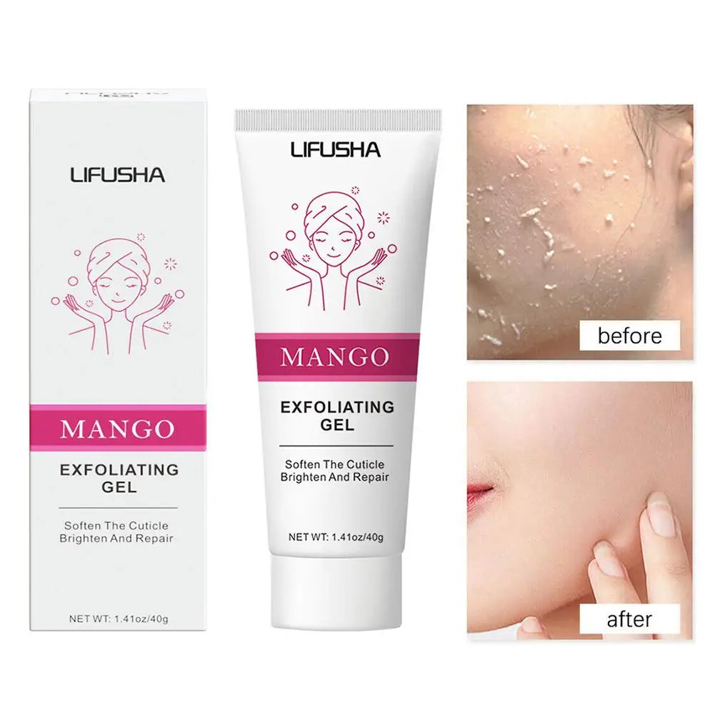 Aloe Vera Face Exfoliating Gel – Blackhead Removal & Pore Refining Cleanser (30g–100g)