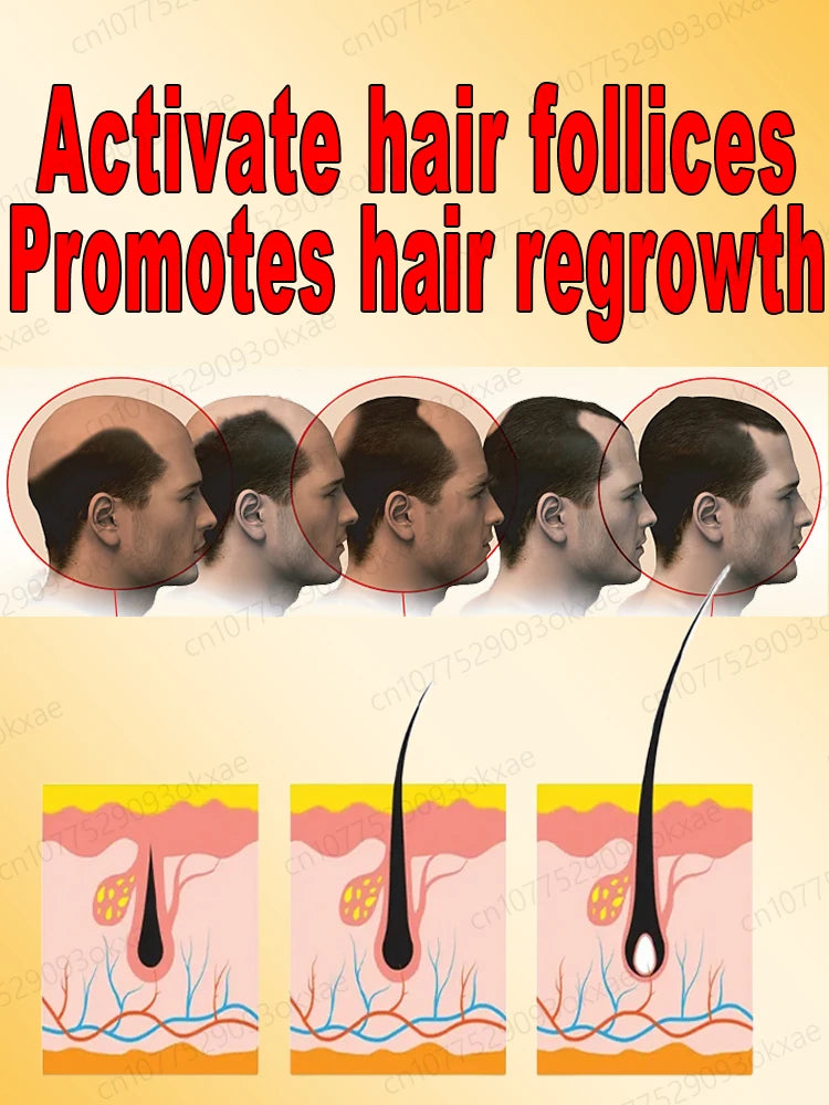 Men’s Hair Regrowth Essential Oil – Targets Bald Spots & Hair Loss, Boosts Thickness Naturally