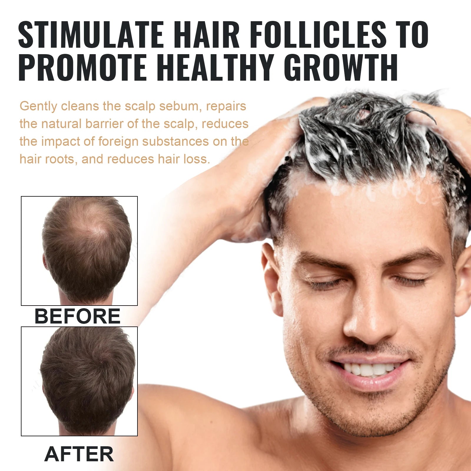 Oil Control & Anti-Dandruff Shampoo