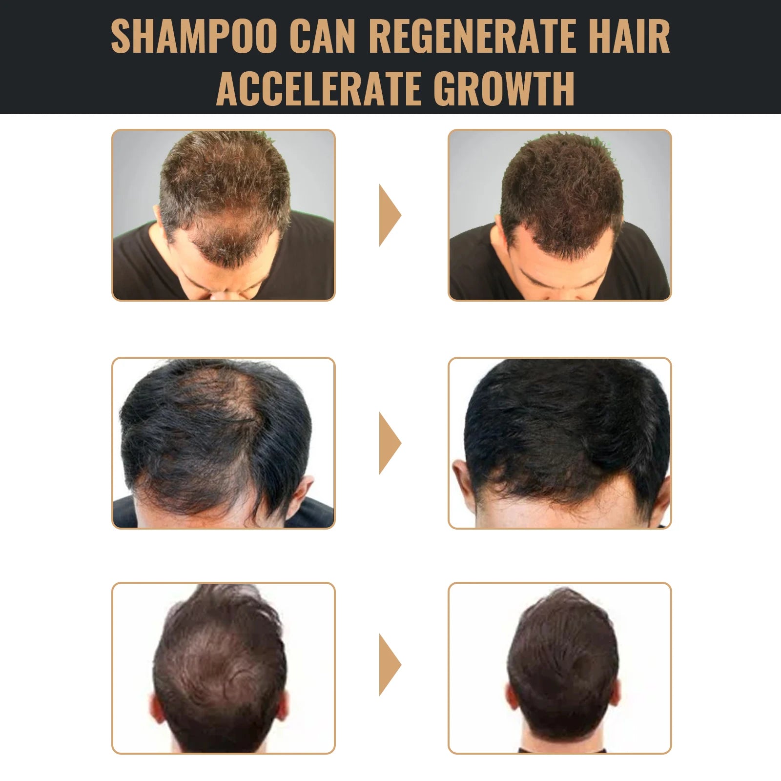 Oil Control & Anti-Dandruff Shampoo