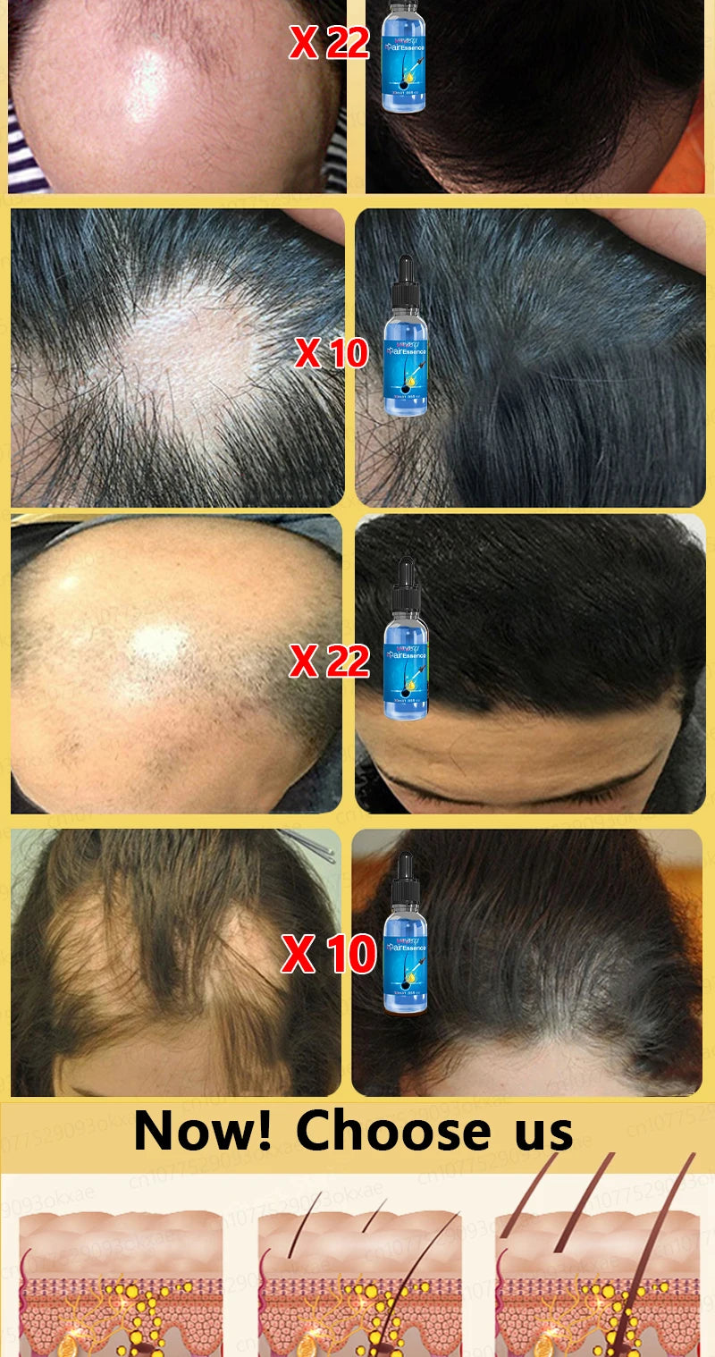 Men’s Hair Regrowth Essential Oil – Targets Bald Spots & Hair Loss, Boosts Thickness Naturally