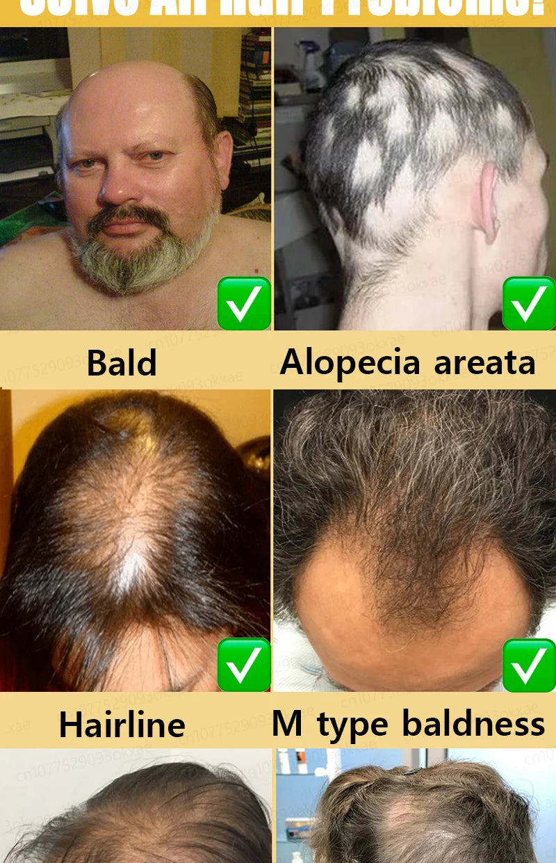 Men’s Hair Regrowth Essential Oil – Targets Bald Spots & Hair Loss, Boosts Thickness Naturally