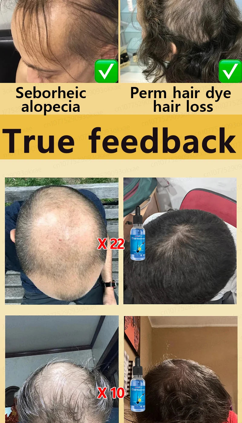 Men’s Hair Regrowth Essential Oil – Targets Bald Spots & Hair Loss, Boosts Thickness Naturally