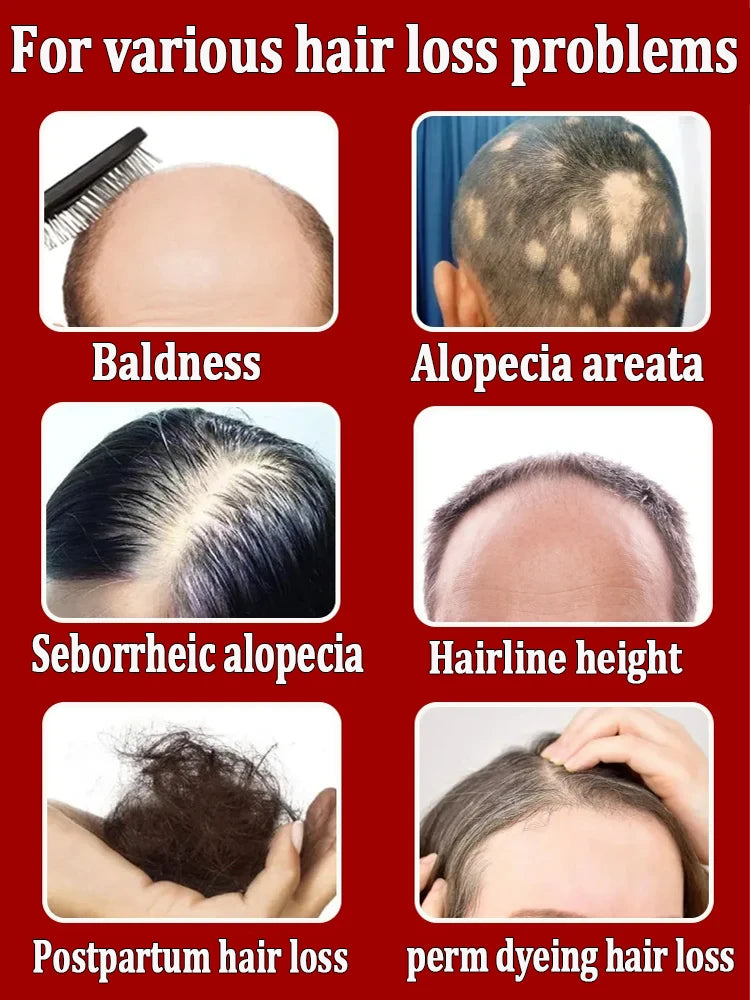 Men’s Hair Regrowth Essential Oil – Targets Bald Spots & Hair Loss, Boosts Thickness Naturally
