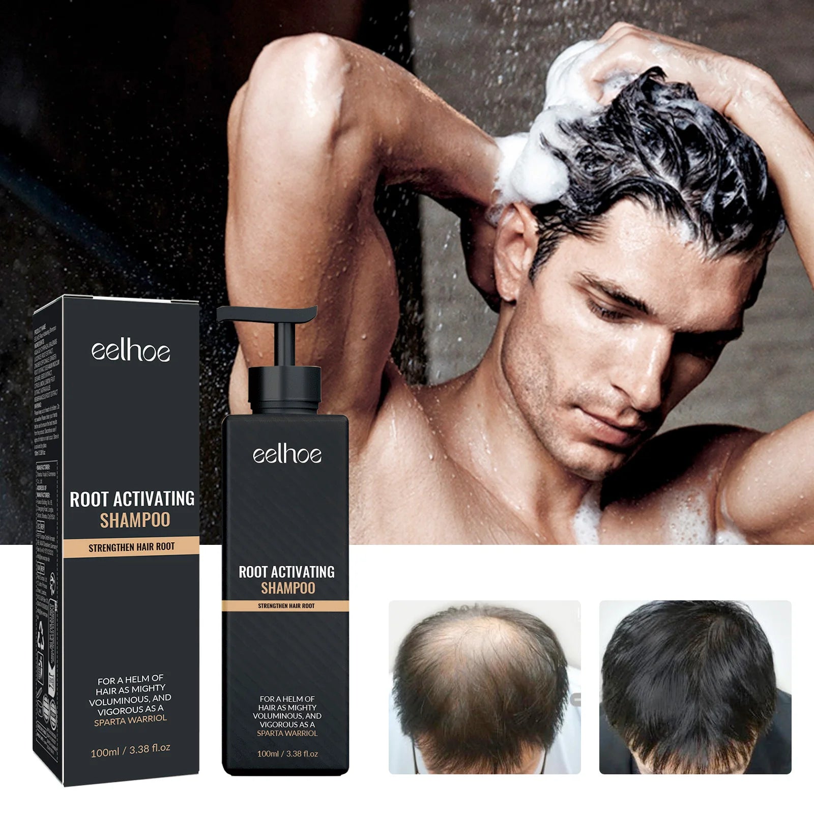 Oil Control & Anti-Dandruff Shampoo