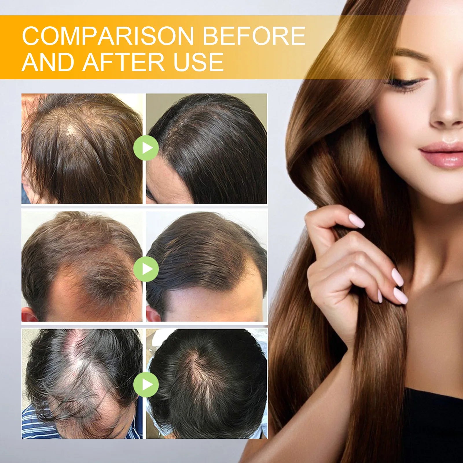 EELHOE Biotin Hair Growth Spray for Men – Strengthen Roots & Thicken Hair (30ml)