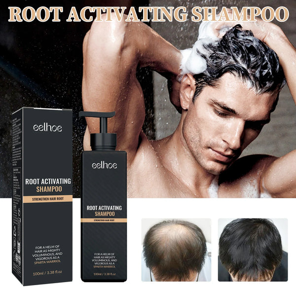 Oil Control & Anti-Dandruff Shampoo