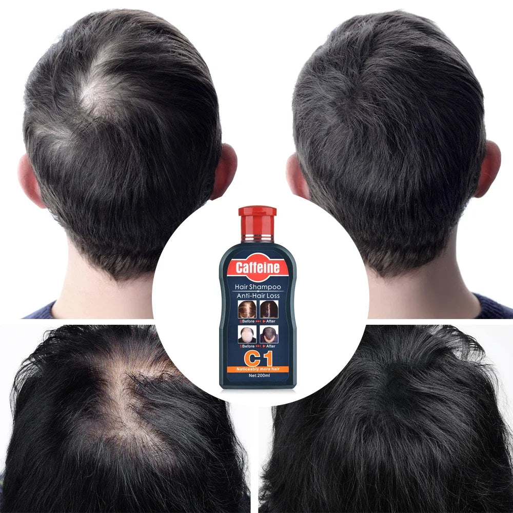 MaxThick™ Anti-Dandruff Shampoo for Stronger, Fuller Hair – 200ml